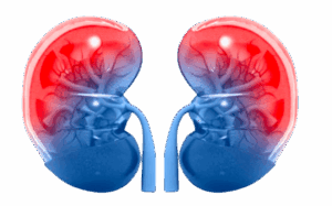 Insuficiência_renal_crônica-removebg-preview