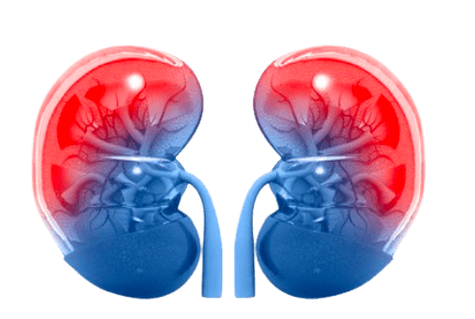 Insuficiência_renal_crônica-removebg-preview