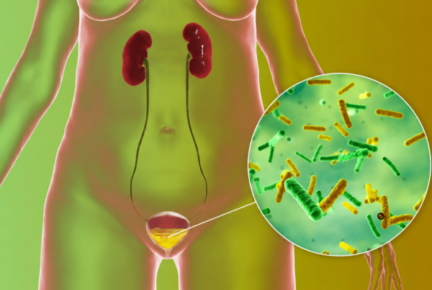 Trato da infecção Urinária